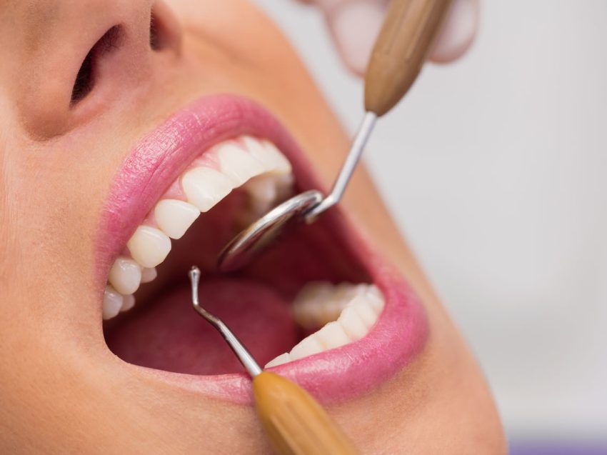 Mundhygiene - professionelle Zahnreinigung Gloggnitz